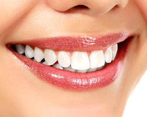 white bright teeth smiling woman