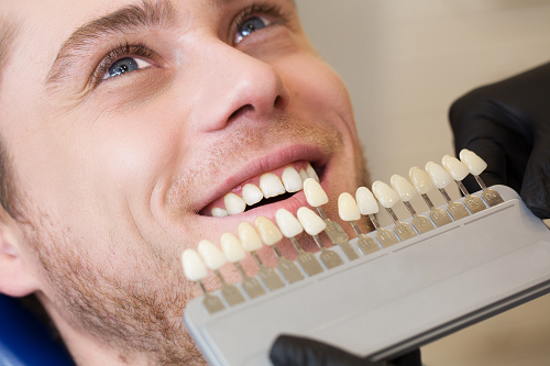 General Dental Practice tooth whitening