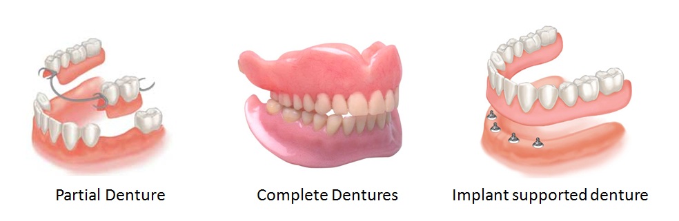 dentures santa cruz